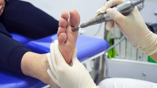 Sesión de quiropodia, pies sanos y cuidados