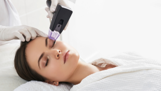 Radiofrecuencia facial